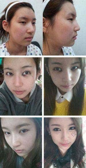 韩国整容医生爆料视频,揭秘整形手术背后的真相 第1张 韩国整容医生爆料视频,揭秘整形手术背后的真相 第1张